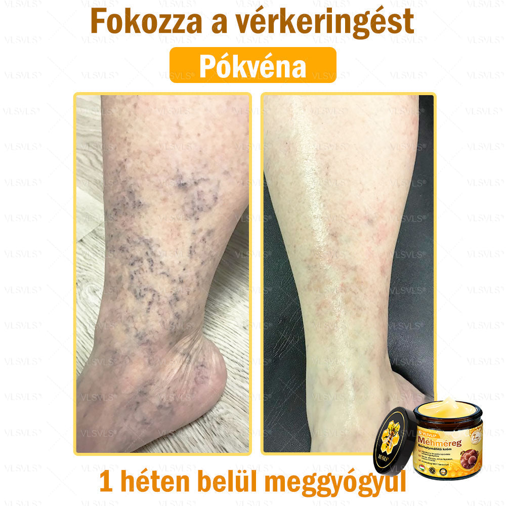 💪💪💪VLSVLS® Méhméreg Bőrhelyreállító Krém (👨⚕CE jóváhagyott)👍✅