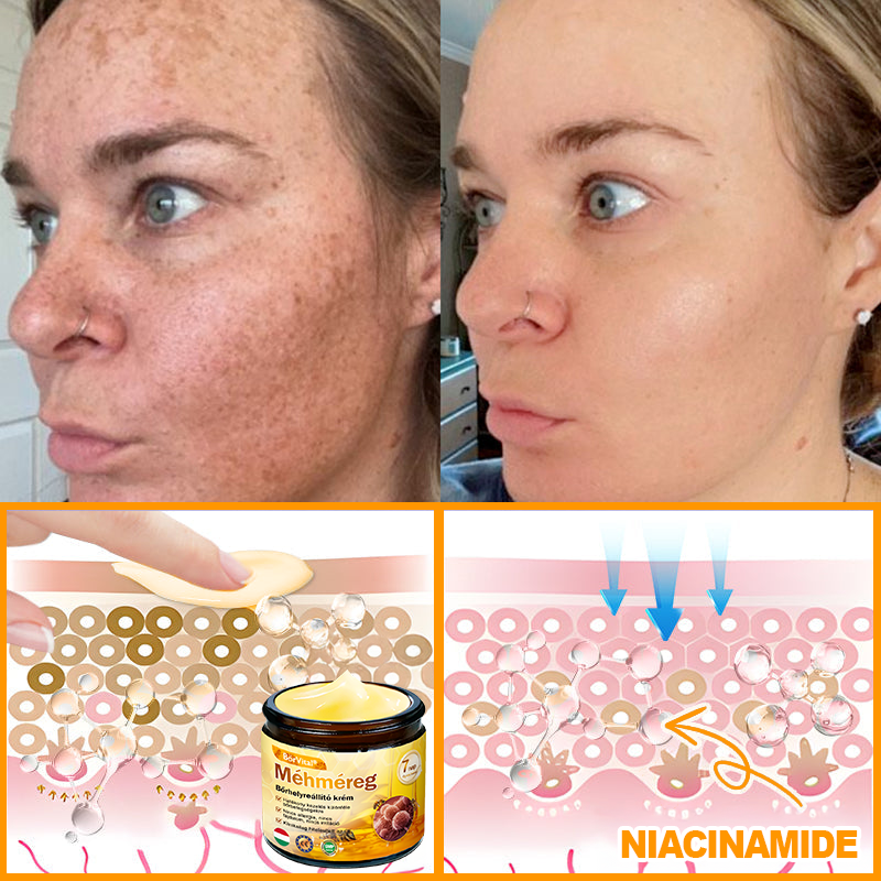 ✨ ZödVita® Méhméreg Bőr Helyreállító Krém 🔥 Magyar fejlesztés, magyarországi gyártás és szállítás