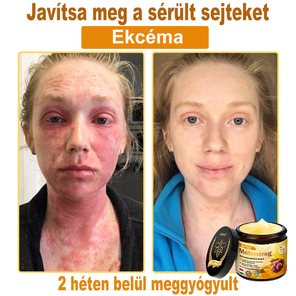 ✨ ZödVita® Méhméreg Bőr Helyreállító Krém 🔥 Magyar fejlesztés, magyarországi gyártás és szállítás