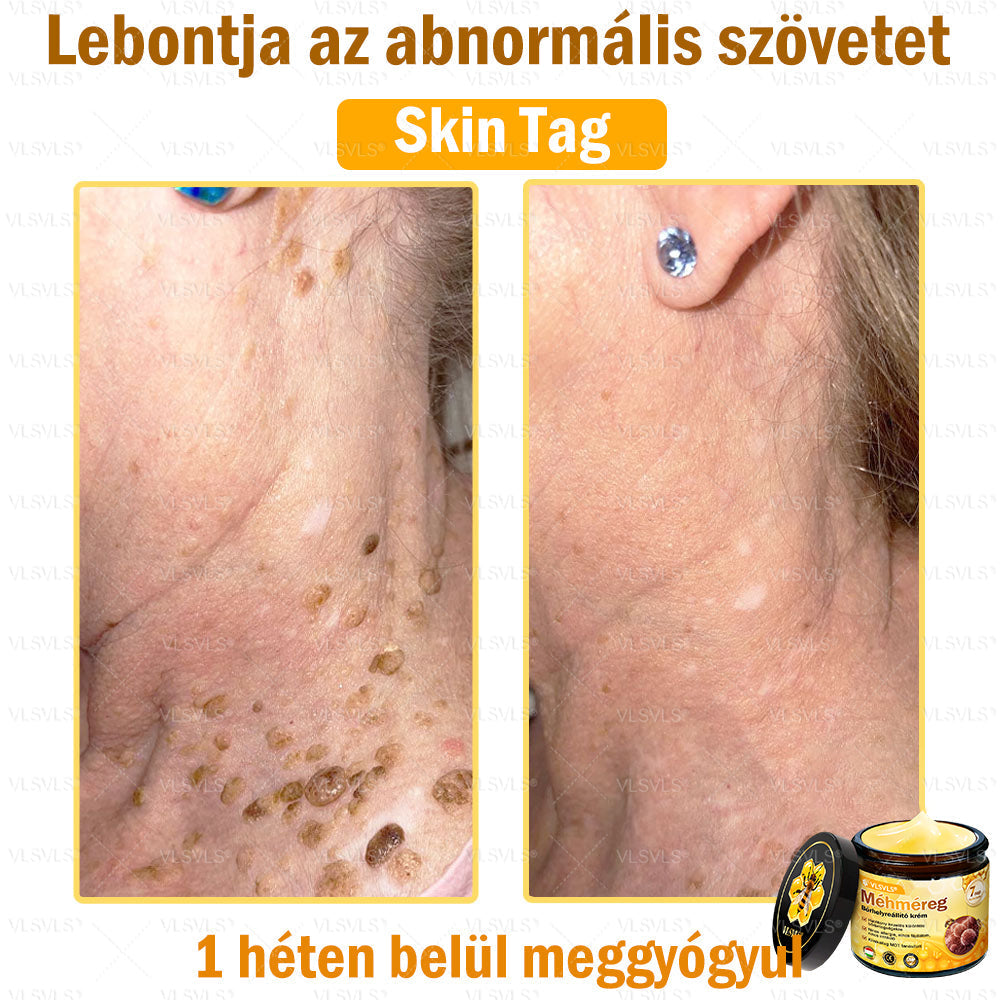 💪💪💪VLSVLS® Méhméreg Bőrhelyreállító Krém (👨⚕CE jóváhagyott)👍✅