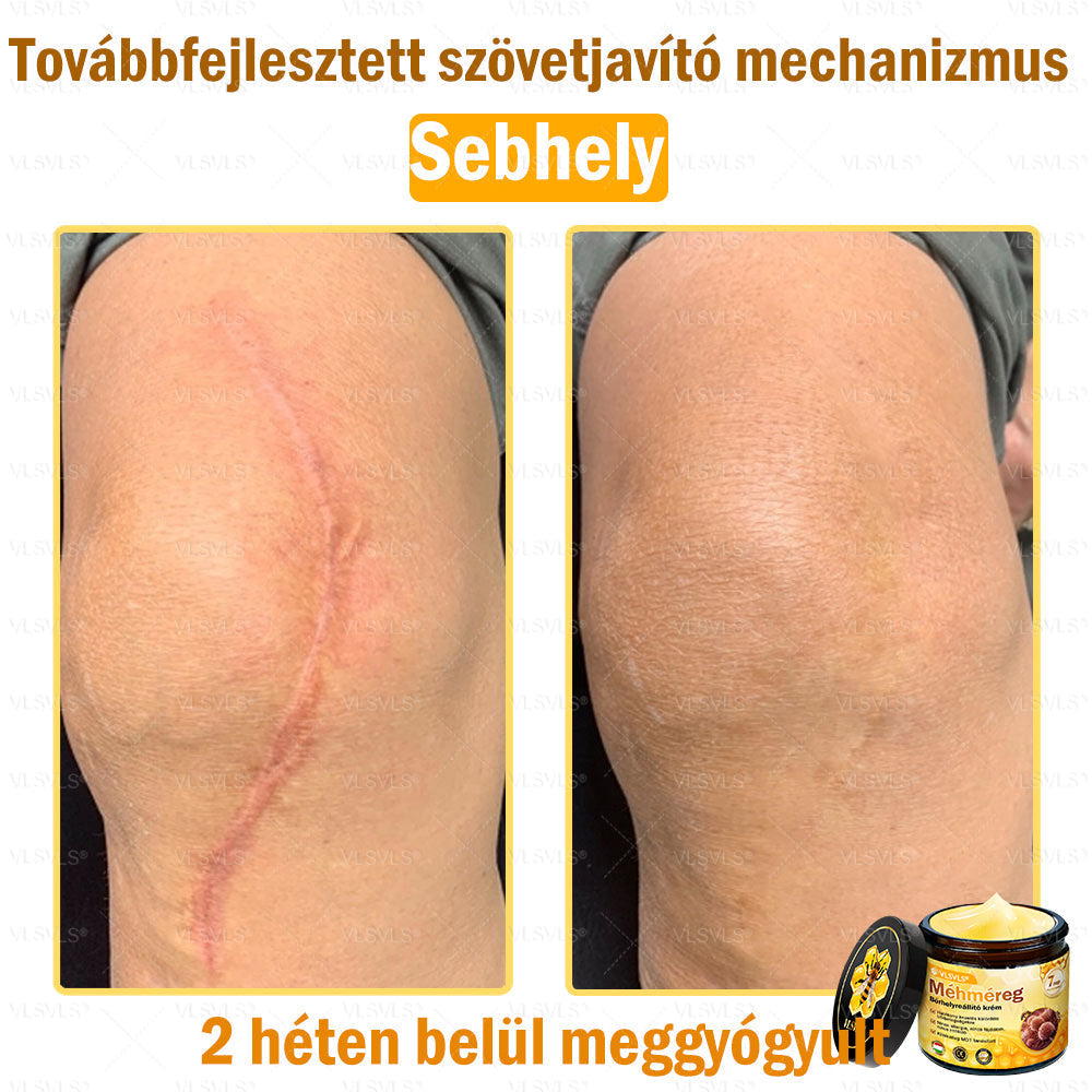 💪💪💪VLSVLS® Méhméreg Bőrhelyreállító Krém (👨⚕CE jóváhagyott)👍✅