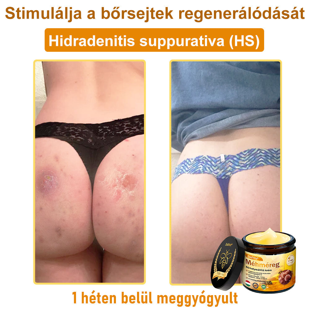 ✨ ZödVita® Méhméreg Bőr Helyreállító Krém 🔥 Magyar fejlesztés, magyarországi gyártás és szállítás