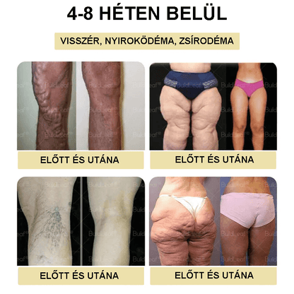 🍎Clinica Cleveland și Mayo | Picături Tirzepatide GIP/GLP-1 cu acțiune dublă pentru slăbit și îmbunătățirea sănătății (Arzător de grăsimi de calitate alimentară – Dezvoltat de Societatea pentru Obezitate)