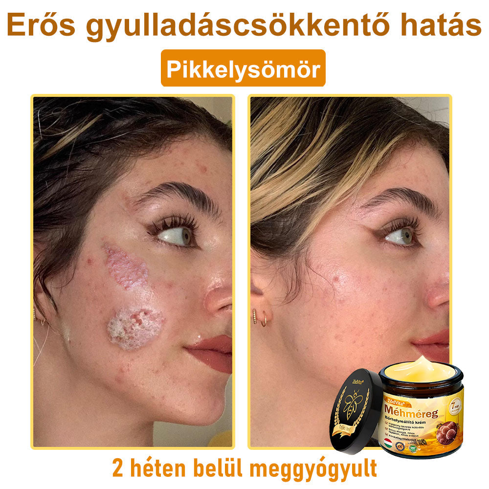 ✨ ZödVita® Méhméreg Bőr Helyreállító Krém 🔥 Magyar fejlesztés, magyarországi gyártás és szállítás