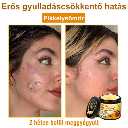 ✨ ZödVita® Méhméreg Bőr Helyreállító Krém 🔥 Magyar fejlesztés, magyarországi gyártás és szállítás