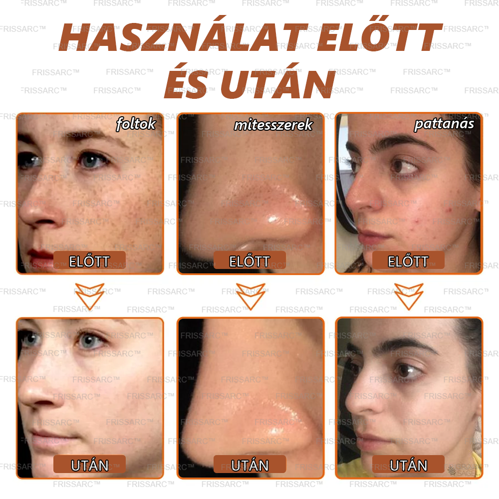🌿FRISSARC™ fehérítő és folteltávolító arcmaszk – Természetes összetevők tartósan eltüntetik a foltokat, szeplőket és napfoltokat.