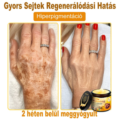 ✨ ZödVita® Méhméreg Bőr Helyreállító Krém 🔥 Magyar fejlesztés, magyarországi gyártás és szállítás
