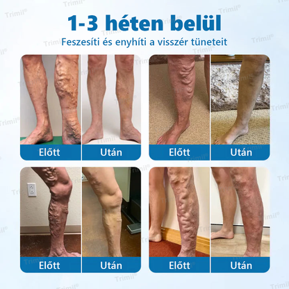 🟢Trimil® VeinGuard Gyógynövényes Spray - ✅ Klinikailag bizonyított, hogy mindössze 7 nap alatt megszünteti a visszereket!