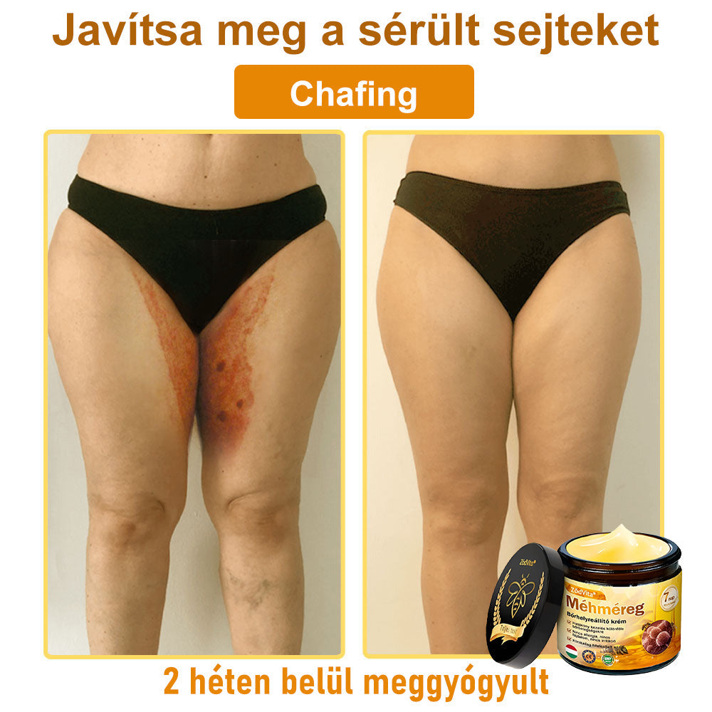 ✨ ZödVita® Méhméreg Bőr Helyreállító Krém 🔥 Magyar fejlesztés, magyarországi gyártás és szállítás