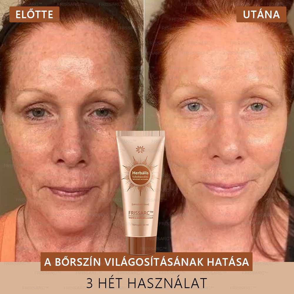 🌿FRISSARC™ fehérítő és folteltávolító arcmaszk – Természetes összetevők tartósan eltüntetik a foltokat, szeplőket és napfoltokat.