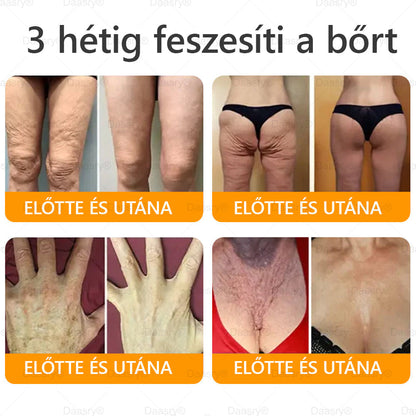 Daasry® Méhméreg Kezelő Krém, méhméreg peptidekkel, botulinum toxinnal, hialuronsavval és kollagénnel💧. Hatékonyan küzd a ráncok, finom vonalak, megereszkedés, terhességi csíkok és sötét foltok ellen — feszesítés, emelés és kiemelkedő eredmények!